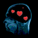 Radiologie: petits coeurs � la place du cerveau