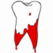 Dent arrach�e