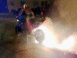 Burn extr�me