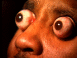 Yeux exorbités